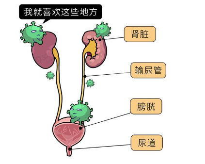 尿路感染反复发作的口服疫苗Uro-Vaxom的使用说明